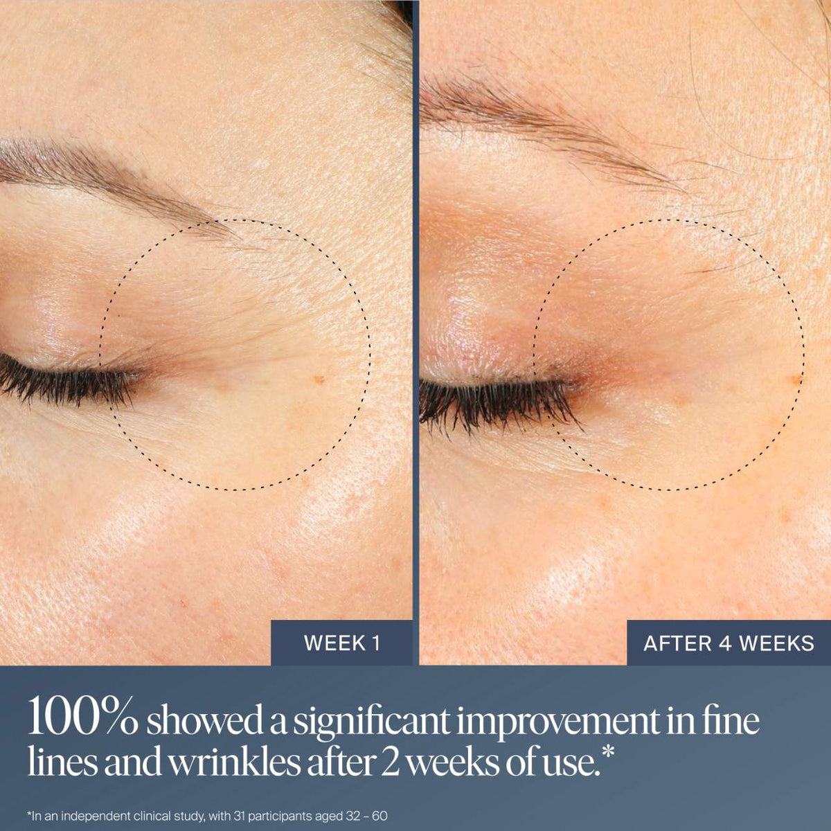 Summer Fridays Jet Lag Overnight Eye Serum for Fine Lines & Wrinkles with Gentle Retinol Blend - 15 ml