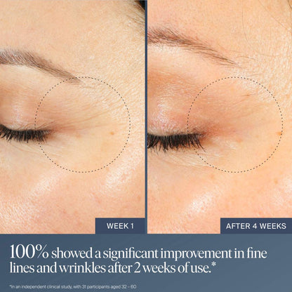 Summer Fridays Jet Lag Overnight Eye Serum for Fine Lines & Wrinkles with Gentle Retinol Blend - 15 ml