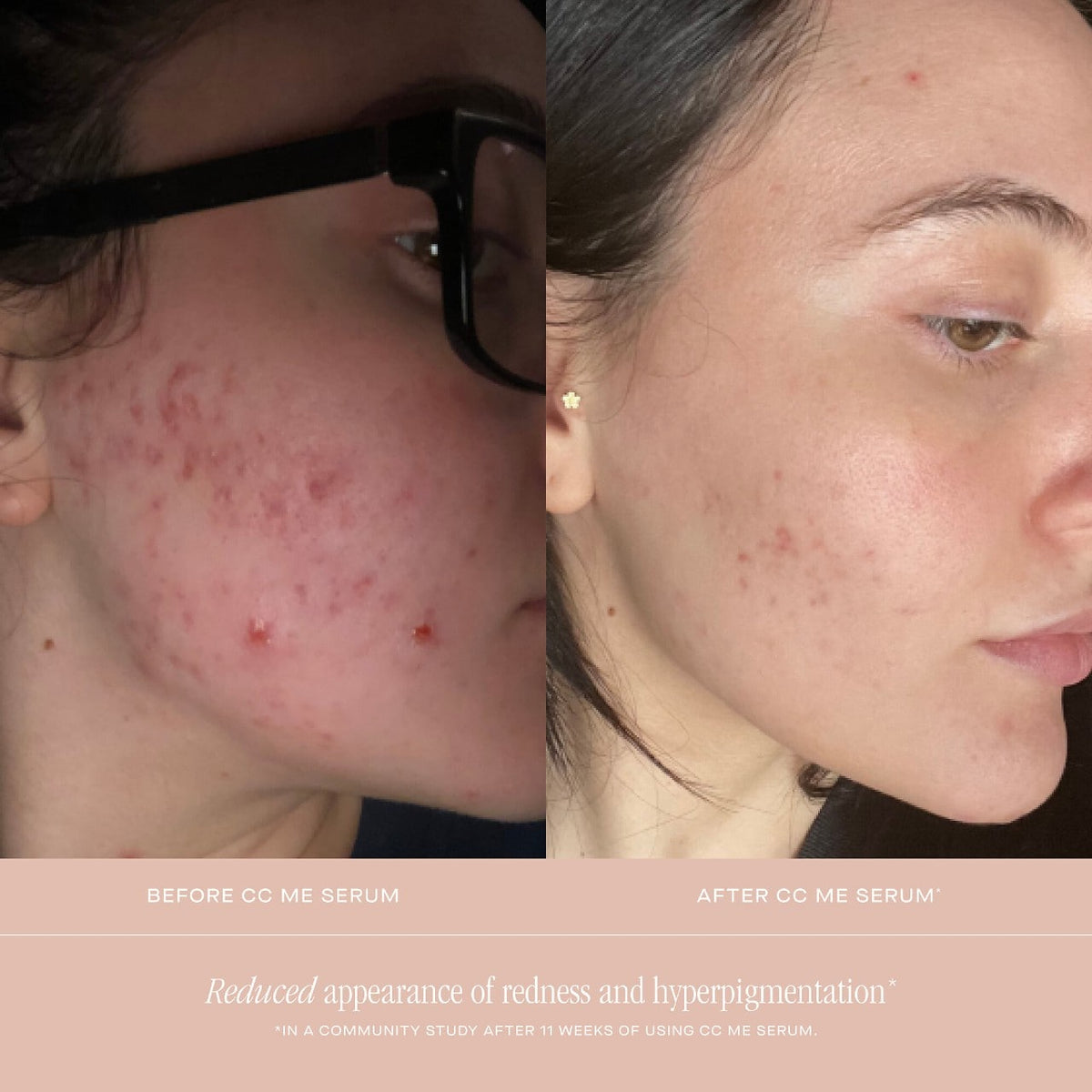 Summer Fridays CC Me Vitamin C + Niacinamide Serum - 30 ml