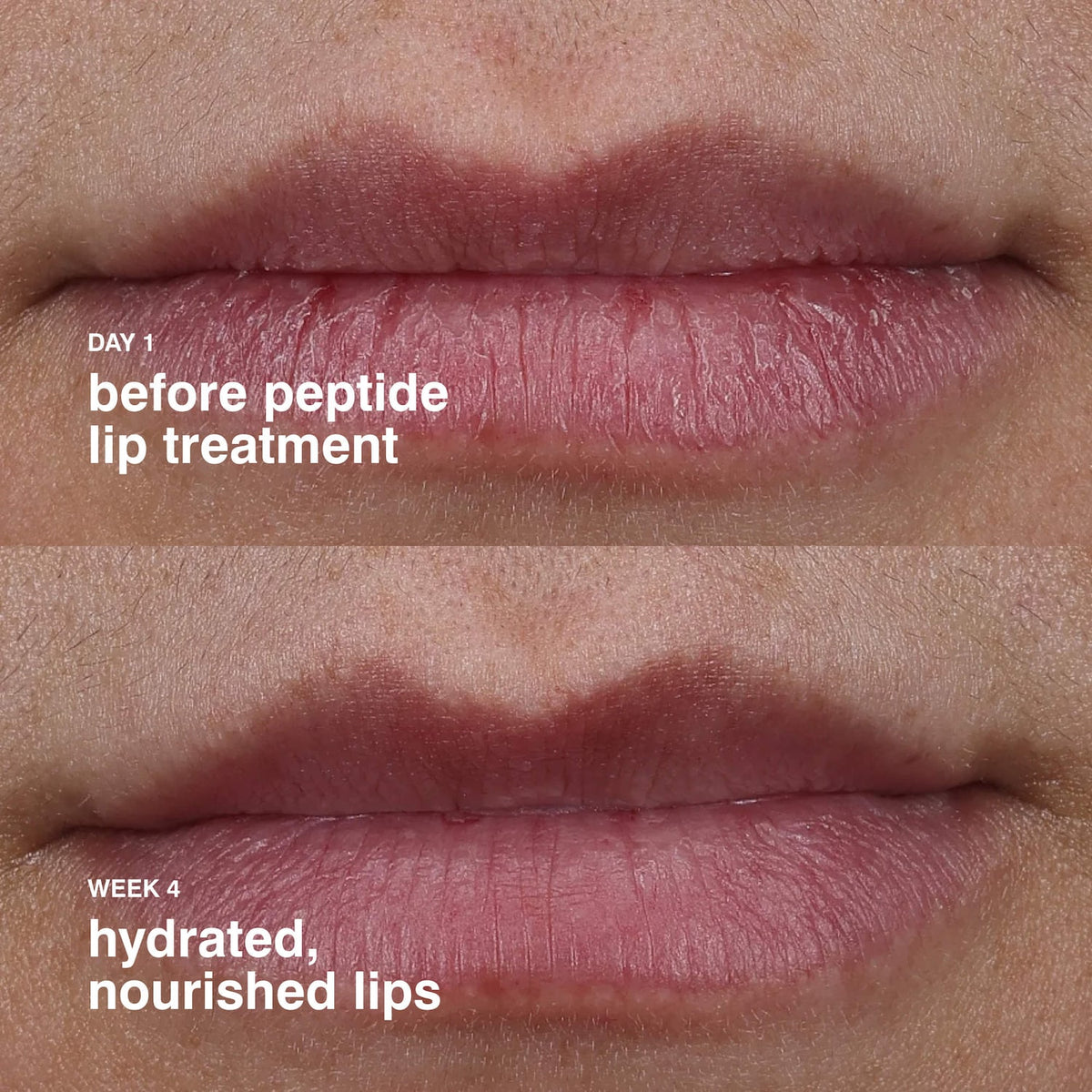 Rhode Peptide Lip Treatment Nourishing Glaze - 10 ml