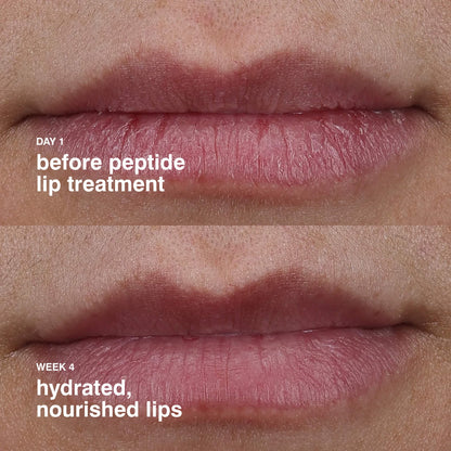 Rhode Peptide Lip Treatment Nourishing Glaze - 10 ml